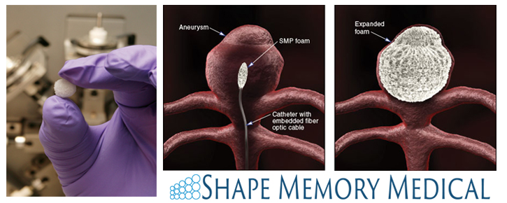 Model of SMP foam being used to block an aneurysm