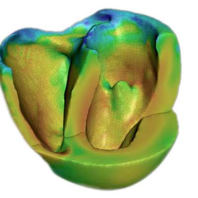 Simulation of a heart by Cardioid