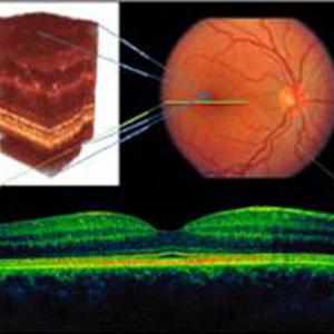 adaptive_optics.jpg adaptive_optics