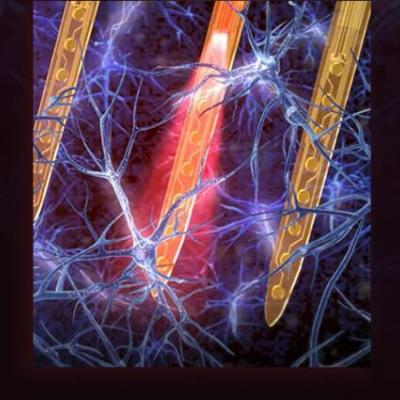 flexible thin-film neural implants