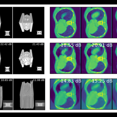 4D Computed Tomography Reconstructions